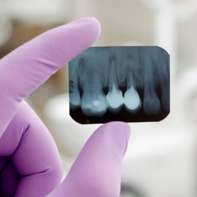 Radiografías Dentales